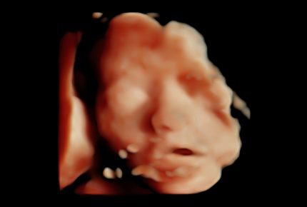 3d baby scan stirling (1)