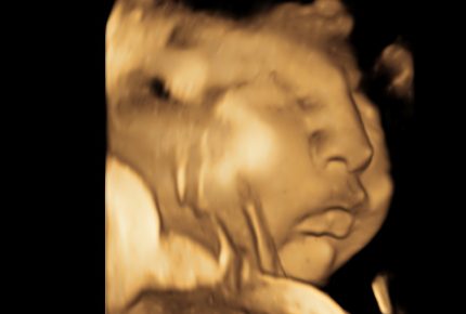 3d baby scan stirling (3)