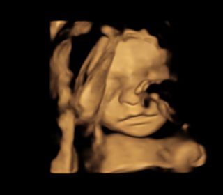 3d baby scan stirling (4)