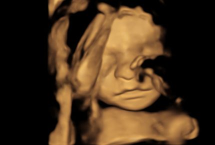 3d baby scan stirling (4)