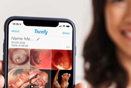 Baby scan images on my phone stirling