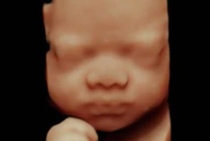 GE image 3D
